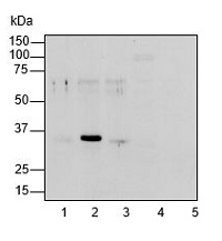 Biotin carboxyl carrier subunit of chloroplast ACCase in the group Antibodies Plant/Algal / Developmental Biology / Lipid metabolism at Agrisera AB (Antibodies for research) (AS15 2881)